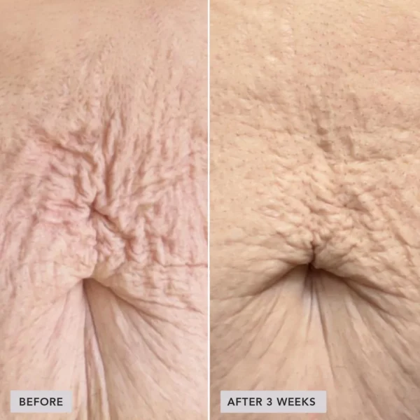 VOL.U.LIFT™ BODY подтягивающий крем для тела