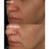 Brightening Boost system